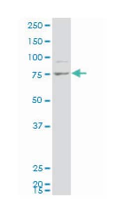 eukaryotic translation initiation factor 4E nuclear import factor 1 (A01),