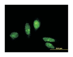 metastasis associated 1 family, member 3, Mouse, Clone: 3B3, Abnova 100&mu;g;