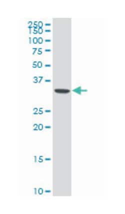 aminoadipate-semialdehyde dehydrogenase-phosphopantetheinyl transferase