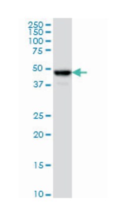 chromosome 17 open reading frame 75, Mouse, Clone: 2D7, Abnova&trade;