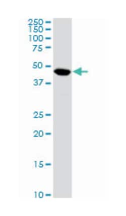 chromosome 17 open reading frame 75, Mouse, Clone: 2D7, Abnova&trade;
