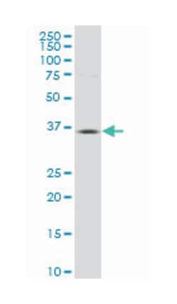 PFTAIRE protein kinase 2 (A01), Mouse anti-Human, Rat, Polyclonal Antibody, Abnova 50 &mu;L | Buy Online | Abnova | Fisher Scientific