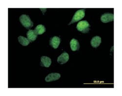 serine/threonine kinase 33, Mouse, Clone: 6G1, Abnova 100&mu;g; Unlabeled:Antibodies,