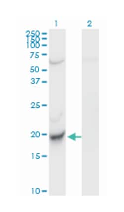 centromere protein M, Mouse, Clone: 4C12-2C8, Abnova 100&mu;g; Unlabeled:Antibodies,