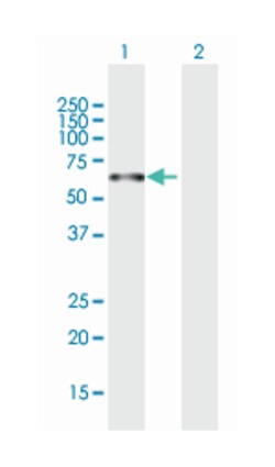 pp9099 (B01), Mouse anti-Human, Polyclonal Antibody, Abnova 50&mu;L; Unlabeled:Antibodies,