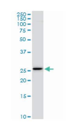 EF-hand domain family, member D1, Mouse, Clone: 1H7, Abnova 100&mu;g; Unlabeled:Antikörper