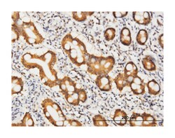 Coenzyme A synthase, Mouse, Clone: 2A12, Abnova 100&mu;g; Unlabeled:Antibodies,