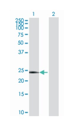 ring finger protein 135, Mouse, Polyclonal Antibody, Abnova&trade;