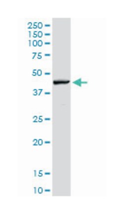 RNF135, Rabbit, Polyclonal Antibody, Abnova 100 &mu;g | Buy Online | Abnova Corporation | Fisher Scientific