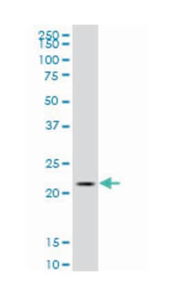chromosome 1 open reading frame 57 (A01), Mouse anti-Human, Polyclonal Antibody, Abnova 50 &mu;L | Buy Online | Abnova Corporation | Fisher Scientific