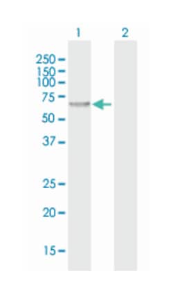 CHMP7, Mouse, Polyclonal Antibody, Abnova 50&mu;g; Unlabeled:Antibodies,