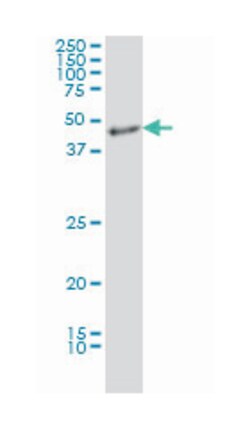 integrin alpha FG-GAP repeat containing 2, Mouse, Clone: 3D4, Abnova 100 &mu;g | Buy Online | Abnova | Fisher Scientific