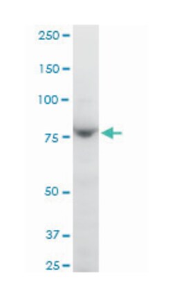 protocadherin gamma subfamily B, 1 (A01), Mouse anti-Human, Mouse, Polyclonal Antibody, Abnova 50 &mu;L | Buy Online | Abnova Corporation | Fisher Scientific
