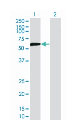 DPYSL5, Mouse, Clone: 2G4, Abnova 100&mu;g; Unlabeled:Antibodies, Monoclonal