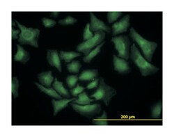 SMAD specific E3 ubiquitin protein ligase 1, Mouse, Clone: 1D7, Abnova