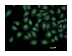 tribbles homolog 3 (Drosophila), Mouse, Clone: 2G5, Abnova 100&mu;g; Unlabeled:Antibodies,