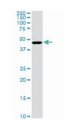 chromosome 17 open reading frame 75, Mouse, Clone: 2D7, Abnova&trade;