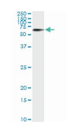 serine/threonine kinase 33, Mouse, Clone: 6G1, Abnova 100&mu;g; Unlabeled:Antibodies,