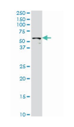 STK33, Mouse, Clone: 4F7, Abnova 200 &mu;L | Buy Online | Abnova Corporation | Fisher Scientific