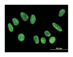 F-box protein 11, Mouse, Clone: 4C12, Abnova 100&mu;g; Unlabeled:Antibodies,