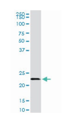 EFHD1, Mouse, Clone: 1F5, Abnova 200&mu;L; Unlabeled:Antibodies, Monoclonal