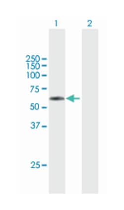 TSEN2, Mouse, Purified MaxPab Polyclonal Antibody, Abnova 50&mu;g; Unlabeled:Antibodies,