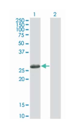 testis-specific serine kinase 3, Mouse, Clone: 3G8, Abnova 100&mu;g; Unlabeled:Antibodies,