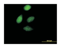 zinc finger protein 276, Mouse, Polyclonal Antibody, Abnova 50&mu;L; Unlabeled:Antibodies,