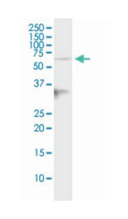 immunoglobulin superfamily, member 8, Mouse, Polyclonal Antibody, Abnova