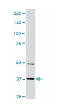 PDZ binding kinase, Mouse, Clone: 3A11, Abnova 100&mu;g; Unlabeled:Antibodies,