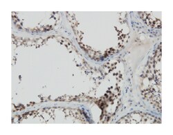 PDZ binding kinase, Mouse, Clone: 3A11, Abnova 100&mu;g; Unlabeled:Antibodies,