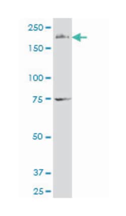 formin 2, Mouse, Polyclonal Antibody, Abnova 50&mu;L; Unlabeled:Antibodies,