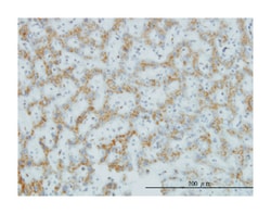 core 1 synthase, glycoprotein-N-acetylgalactosamine 3-beta-galactosyltransferase,