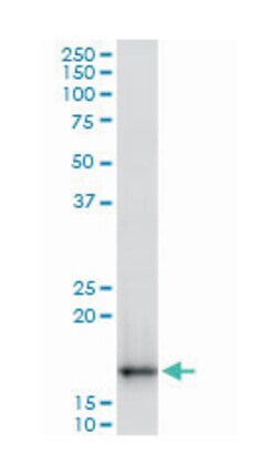 translocase of outer mitochondrial membrane 22 homolog (yeast), Mouse,