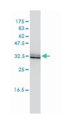 single immunoglobulin and toll-interleukin 1 receptor (TIR) domain, Mouse,
