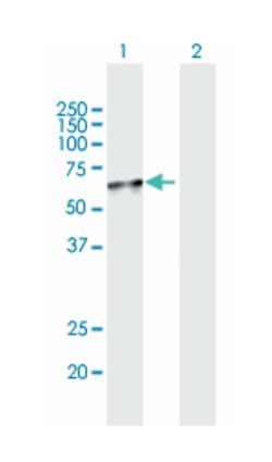 NAD kinase, Mouse, Polyclonal Antibody, Abnova 50&mu;L; Unlabeled:Antibodies,