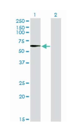 serine/threonine kinase 33, Mouse, Clone: 6G1, Abnova 100&mu;g; Unlabeled:Antibodies,
