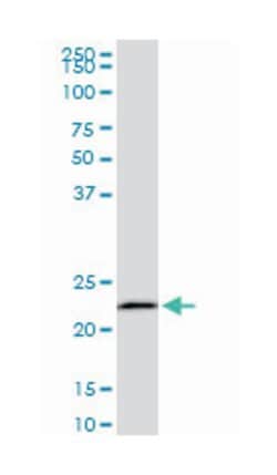 EFHD1, Mouse, Clone: 1F5, Abnova 200&mu;L; Unlabeled:Antibodies, Monoclonal