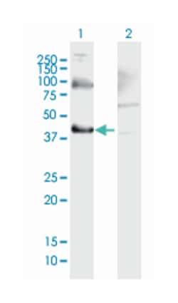 THOC3, Mouse, Polyclonal Antibody, Abnova 50 &mu;g | Buy Online | Abnova Corporation | Fisher Scientific
