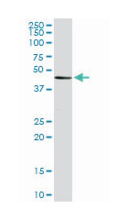 transcriptional adaptor 2 (ADA2 homolog, yeast)-beta, Mouse, Clone: 1C8,
