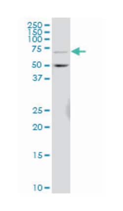 ceramide kinase (A01), Mouse anti-Human, Polyclonal Antibody, Abnova 50&mu;L;