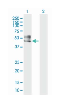 RTN4R (D01P), Rabbit anti-Human, Polyclonal Antibody, Abnova 100 &mu;g | Buy Online | Abnova Corporation | Fisher Scientific