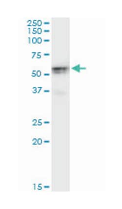 hexokinase domain containing 1, Mouse, Clone: 3A2, Abnova 100&mu;g; Unlabeled:Antibodies,