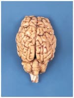 Carolina™ Formalin Preserved Sheep Brain, Dura Mater Removed