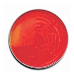 BD BBL™ Prepared Plated Media: Trypticase™ Soy Agar (TSA II™) with Sheep Blood