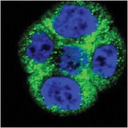 anti-CTLA-4/CD152, Polyclonal, Invitrogen 400&mu;L; Unlabeled:Antibodies,