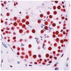 DNA-PKcs Monoclonal Antibody, Clone: 18-2 + 25-4 + 42-psc, Invitrogen 500&mu;L;