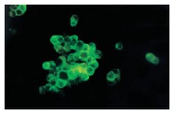 MilliporeSigma anti-Nerve Growth Factor Receptor, p75 ; Polyclonal; (Chemicon