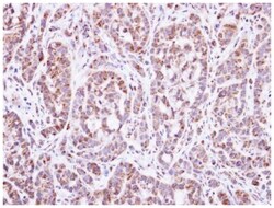 DGAT2 Polyclonal Antibody, Invitrogen 100&mu;L; Unlabeled:Antibodies, Polyclonal