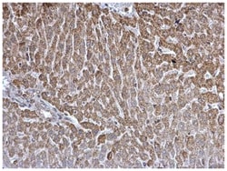 DGAT2 Polyclonal Antibody, Invitrogen 100&mu;L; Unlabeled:Antibodies, Polyclonal